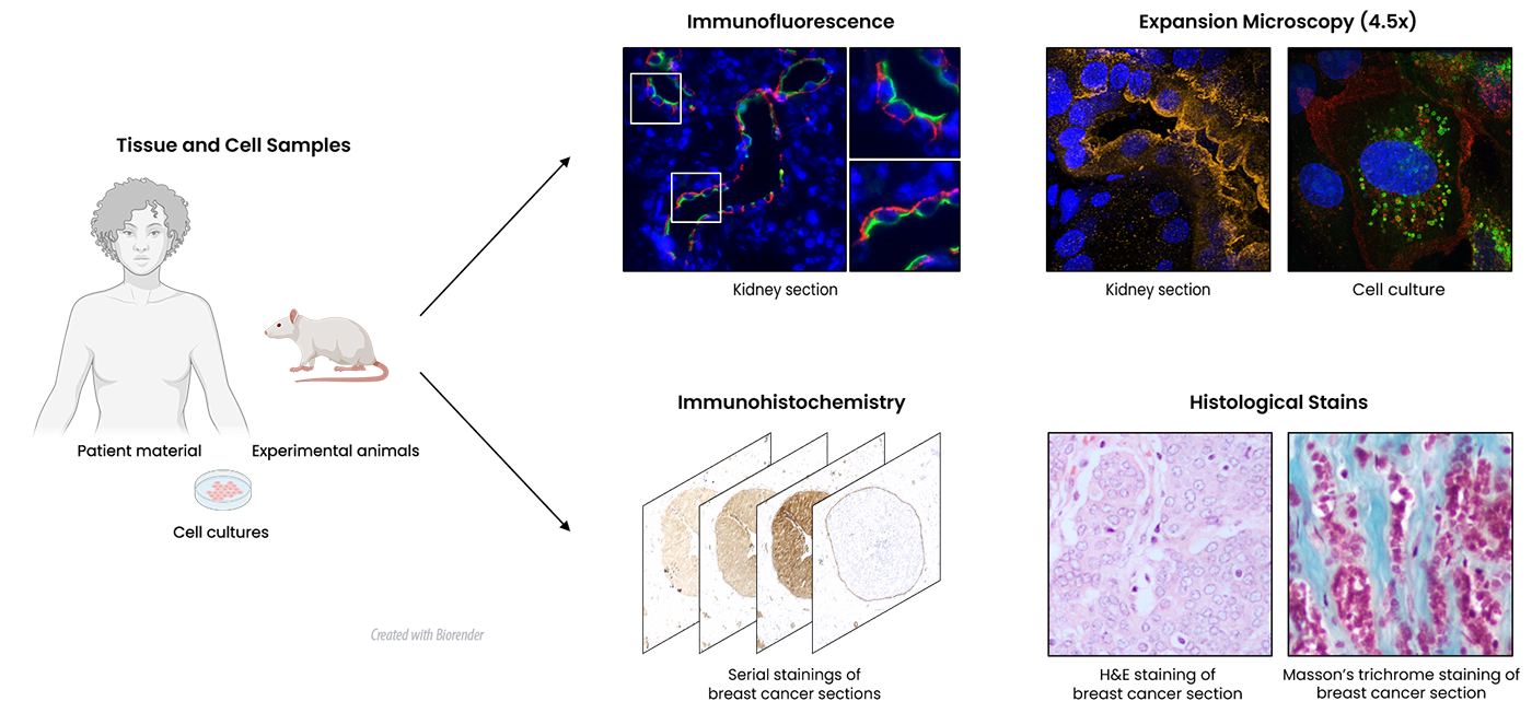 Abstrakt, der viser mikroskopiteknikker, afdelingen kan udføre: Immunfluorescens, ekspansionsmikroskopi, immunhistokemi og histologisk farvning.